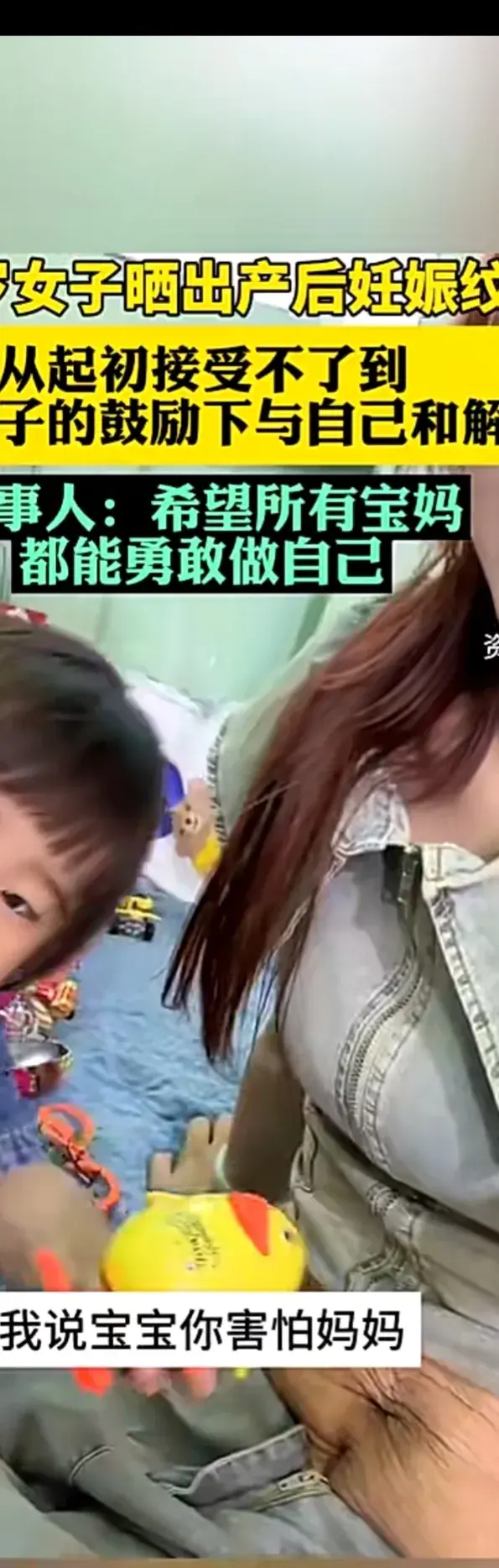 27歲寶媽與自己的妊娠紋和解了